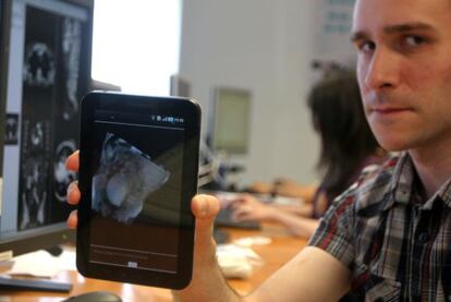 Imagen médica en 3D en una tableta, ayer en la presentación del proyecto de Vicomtech-IK4.