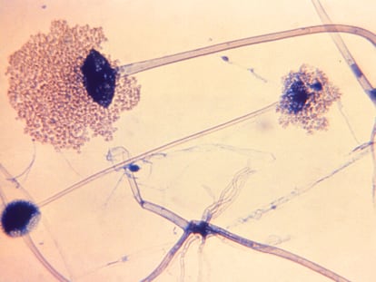 El hongo Rhizopus arrhizus, causante del 70% de las infecciones de mucormicosis conocidas como hongo negro.