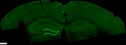 Secci&oacute;n del cerebro de un rat&oacute;n con la zona activada en verde m&aacute;s claro.