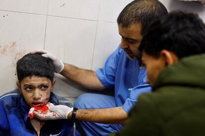 Un niño herido en un ataque israelí recibe asistencia en el hospital Nasser, este sábado en Jan Yunis. 