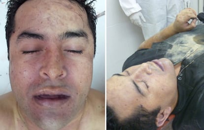 Fotografías del cadáver de Lazcano difundidas por la Marina Armada de México.
