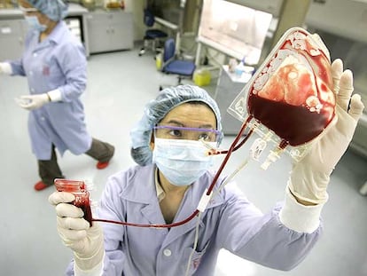 Manipulación de un cordón umbilical para conservar las células que contiene su sangre.