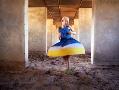 Kelen, de 11 años, en los dormitorios en construcción del centro para albinos de Kabanga, en Tanzania.