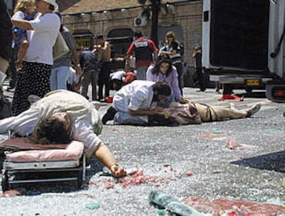 Heridos por una bomba en Jerusalén en agosto.