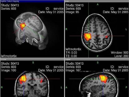 Una imagen por resonancia magnética funcional mide la cantidad de oxígeno consumido por las neuronas en zonas del cerebro de entre 2 y 8 milímetros cúbicos.