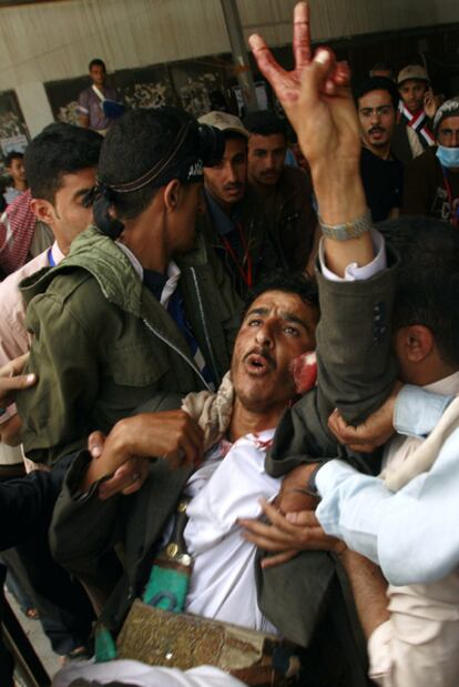 Un activista antigubernamental herido es evacuado por sus compañeros en Saná.