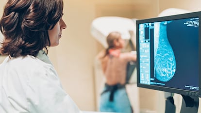 El diagnóstico precoz del cáncer de mama, el más frecuente entre las mujeres, eleva la tasa de supervivencia al 90%.
