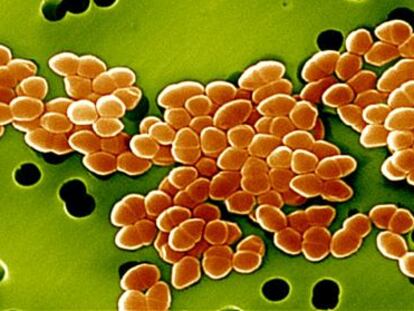 Bacterias resistentes a los antibi&oacute;ticos.
