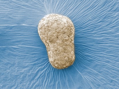 Um modelo de embrião humano visto com um microscópio eletrônico.