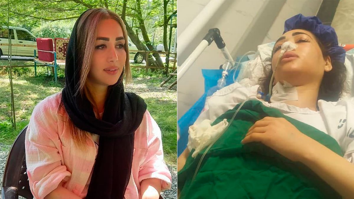 Una mujer queda paralítica tras ser tiroteada por la policía en Irán por no usar velo 