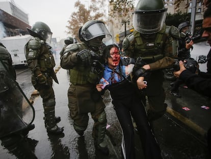 El debate que abre en Chile la joven herida en la manifestación estudiantil: el Gobierno de Kast acusa “victimización selectiva”