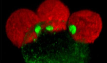 A cell attacked by the HIV virus.