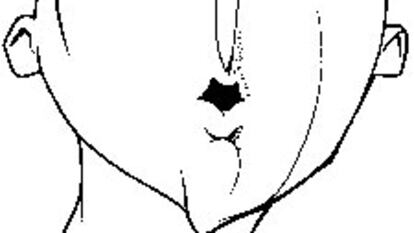 Caricatura de Tamudo