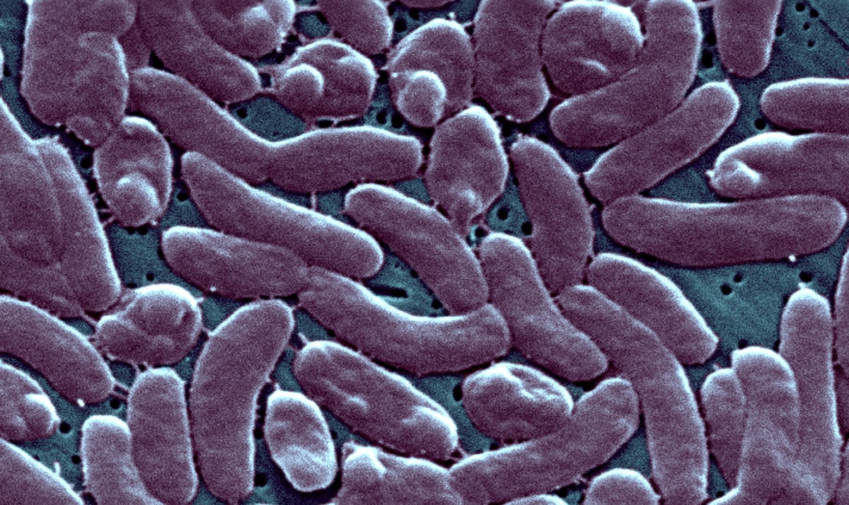 Vibrio vulnificus: Concern in Florida about the increase in the ‘flesh-eating’ bacteria after the passage of hurricanes