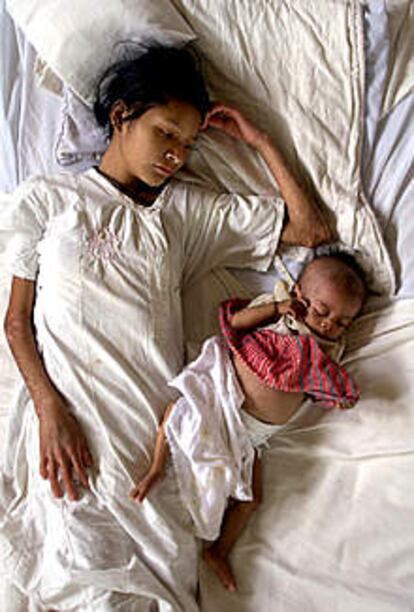 Una madre y su hija, afectadas de desnutrición, yacen en una cama de un hospital de Jocotán.