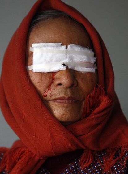 DETENER LA OSCURIDAD. Ta Thi Hac, campesina de la provincia de Thai Binh, tras ser operada de tracoma en los dos ojos por los oftalmólogos españoles