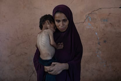 Un niño palestino que sufre de malnutrición junto a su madre, este sábado en el campo de refugiados Al Shati, al este de Gaza. 