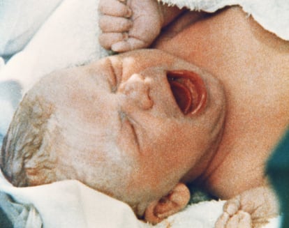 Louise Brown, la primera bebé probeta del mundo chilla después de nacer por cesárea en el hospital Oldham en Lancashire.