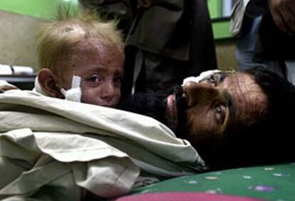 El niño afgano Azizullah, de un año, en brazos de su tío Ahmanzai en el hospital de Jalalabad. Los dos afirman que resultaron heridos en Karam, a 50 km de Jalalabad, durante el ataque aéreo de EE UU. 
(AP)