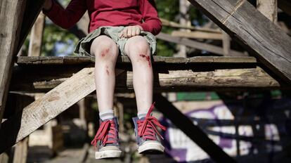 Un ni&ntilde;o con varias heridas en las rodillas.