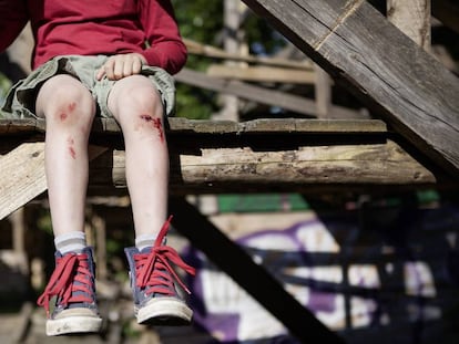 Un ni&ntilde;o con varias heridas en las rodillas.