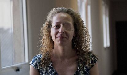 Ester Quintana, 42 años, perdió un ojo el 14-N tras una manifestación en Barcelona el día de la huelga general.
