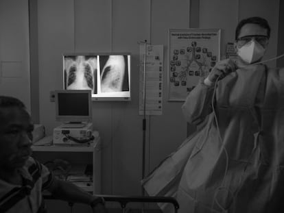 Um homem com tuberculose no Hospital Ary Parreiras, em Niterói.