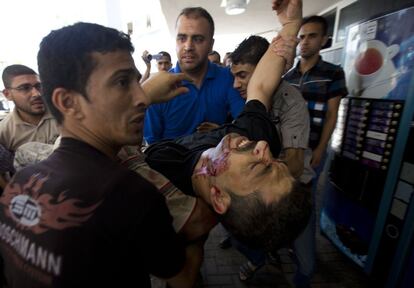 Un herido palestino es trasladado al hospital Al Shifa en Gaza tras un bombardeo, el 8 de julio.