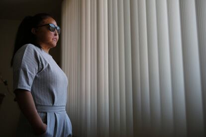 Carmen Sánchez sobrevivió a un ataque con ácido de su expareja hace siete años, cuando ella tenía 30. Se sometió a 61 cirugías y debe proteger su piel y ojo derecho del sol.