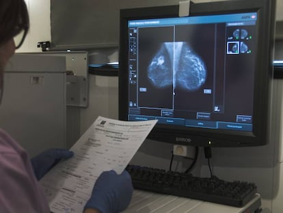 Revisión de una mamografía.