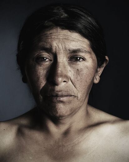 Imagen perteneciente a la serie sobre mujeres bolivianas maltratadas.