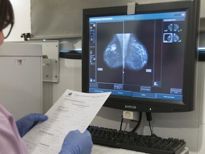 Mamografía realizada en 2014 en Andalucía a una mujer en una unidad móvil de detección precoz de cáncer de mama.