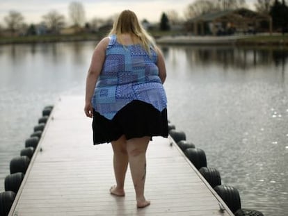 Un 30% de los pacientes que se operan de obesidad m&oacute;rbida vuelve a engordar