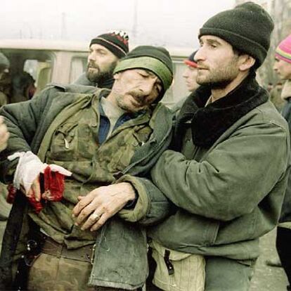 Uno de los heridos chechenos.