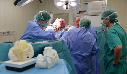 Momento de la intervención a Marc, el primer paciente del que se imprimió su tumor en 3D para ensayar la extracción. La maqueta 3D con el material que simula el tumor, en primer plano.