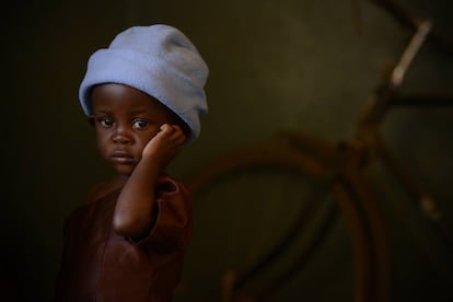 Desire, de dos años vive en Balaka, Malawi, y sufre desnutrición aguda.
