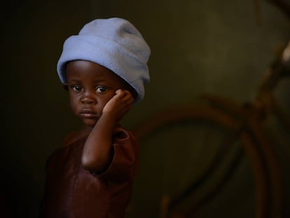 Desire, de dos años vive en Balaka, Malawi, y sufre desnutrición aguda.