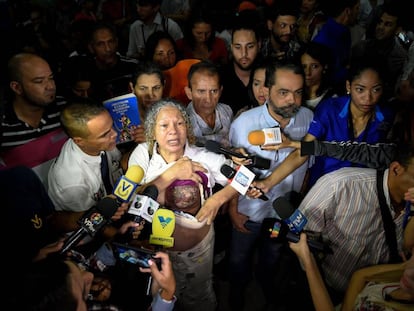 Elizabeth Salazar muestra su seno izquierdo a la prensa venezolana. 
