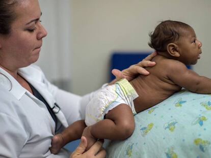 Una terapeuta trata a un beb&eacute; con microcefalia debido al virus del zika el pasado 22 de enero en Salvador, Brasil. 