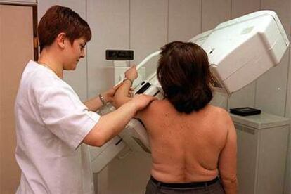 Una mujer se somete a una prueba de mamografía.