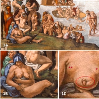 En esta imagen se observa el supuesto cáncer de mama en 'El diluvio'. En la imagen 1F, mujer mayor con pechos saludables representada en el lado superior derecho de 'El Juicio Final' (Capilla Sixtina).