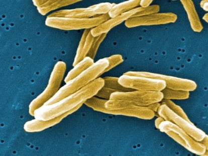 Bacterias de la tuberculosis.