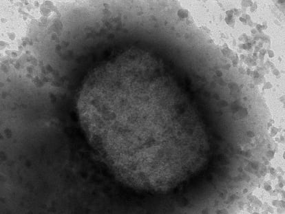 Imagen obtenida por microscopía electrónica del virus de la viruela del mono.