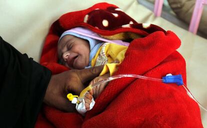 Una ni&ntilde;a enferma de c&oacute;lera recibe tratamiento en un hospital en San&aacute;, la capital de Yemen, el pasado 19 de septiembre.