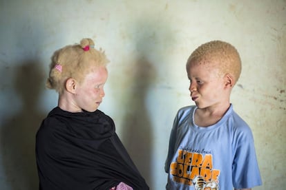 Lucmani le cuenta a su hermana Aisha las travesuras de hoy en el colegio. A ambos les gusta mucho ir a la escuela y nunca se han sentido diferentes. Tienen montones de amigos y se pasan el día jugando. Tienen la suerte de pertenecer a una familia muy concienciada y muy consciente de la vulnerabilidad y la discriminación que sufren los albinos, considerados personas con discapacidad debido a la delicadeza de su piel y de sus ojos. “Si tu no la señalas, la diferencia no existe. Al menos yo no veo ninguna, por eso creo que los demás tampoco la ven” asegura su abuela Mafanta.