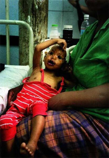 Un niño enfermo de sida en un hospital de Mozambique.