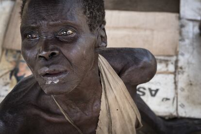 Como tantos sudaneses del sur, esta anciana sufre de inanición. Desde la crisis de 2013, los dos bandos rivales mantienen un enfrentamiento que ha costado al país una guerra civil, combates, enfermedades y hambre.