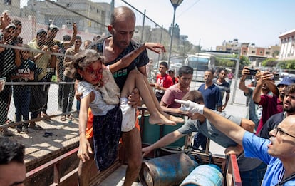 Una niña herida en Gaza llega al hospital de Jan Younis, el 22 de julio de 2024.