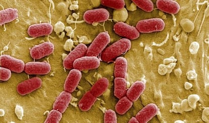 Colonia de Escherichia coli, una bacteria fecal.