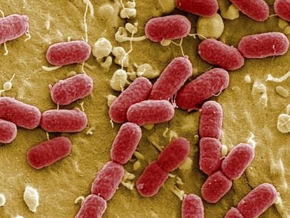 Colonia de Escherichia coli, una bacteria fecal.